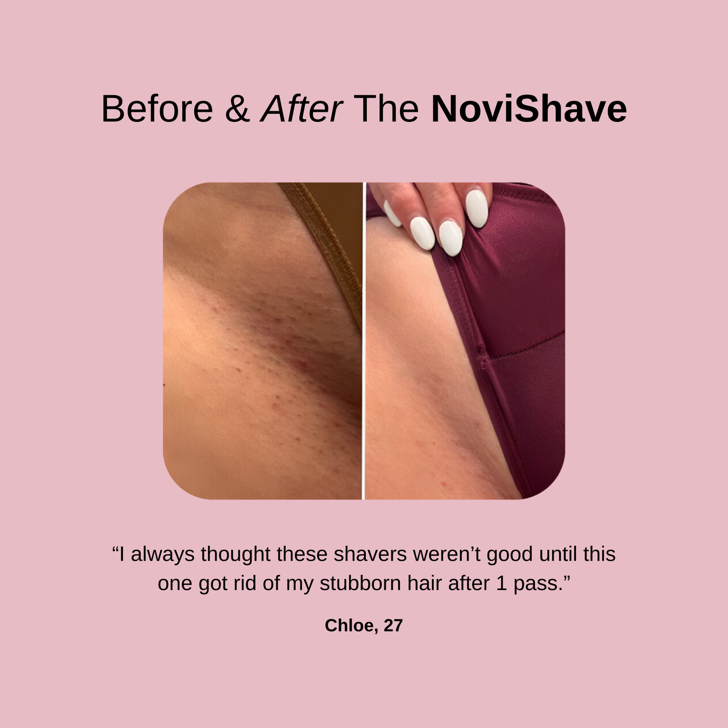 The 2-in-1 NoviShave